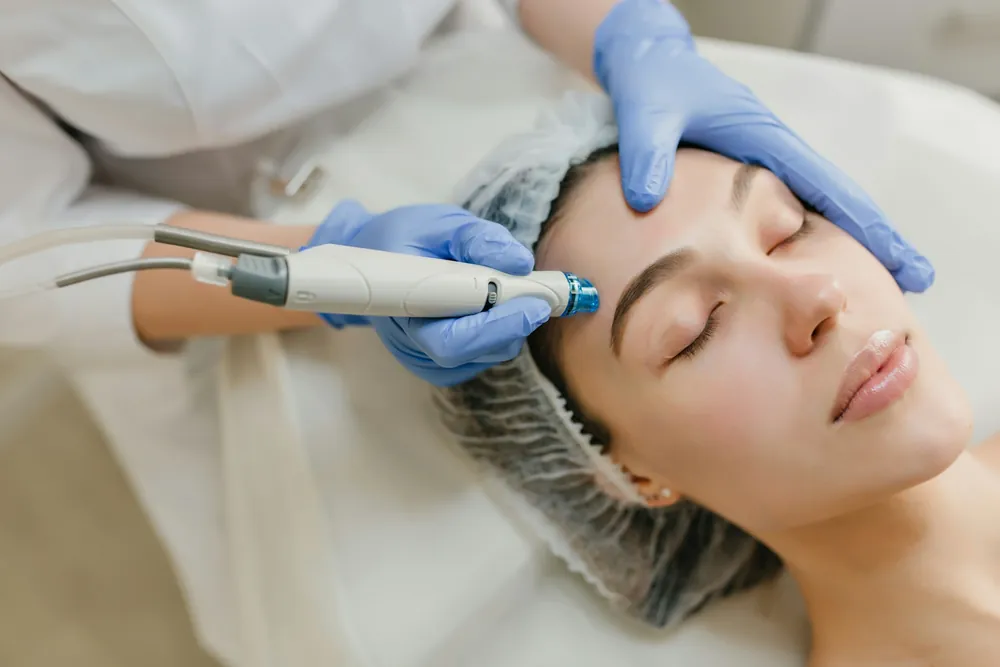 Aplicação de laser em tratamento facial
